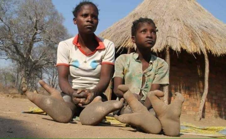 two-toed-tribe-in-africa